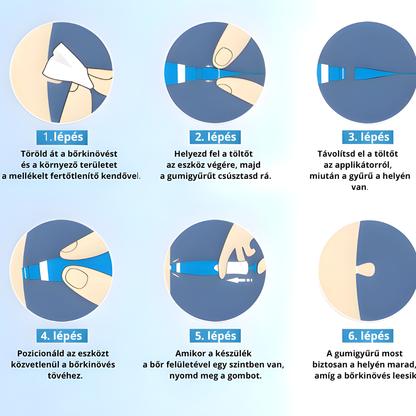 Bőrkinövés Eltávolító Készlet NUVAI